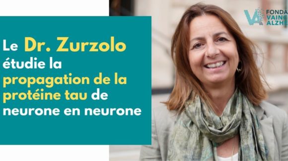 La propagation de la protéine tau dans le cerveau malade d’Alzheimer